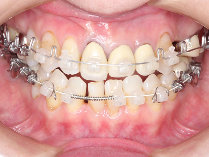 orthodontics-01.jpg