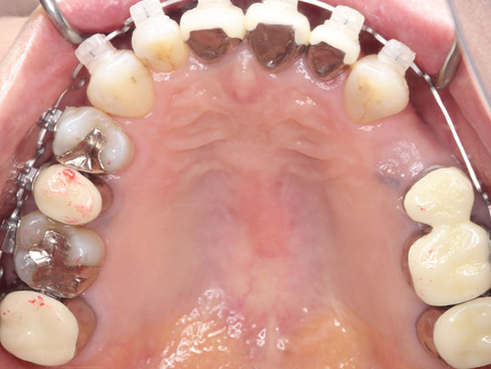 orthodontics-02.jpg