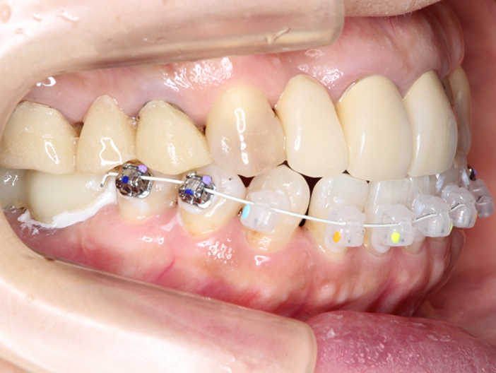 orthodontics-01-4.jpg