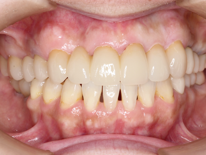 orthodontics-01-5.jpg