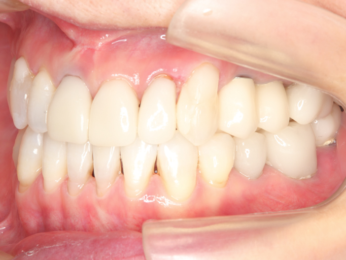 orthodontics-08.jpg