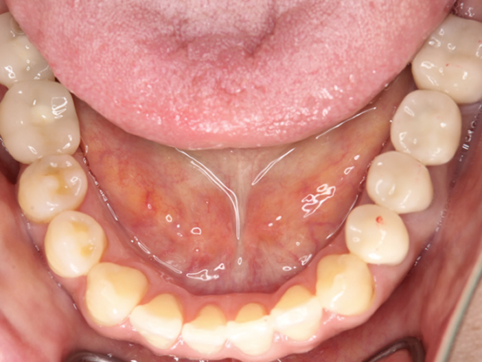 orthodontics-01-7.jpg