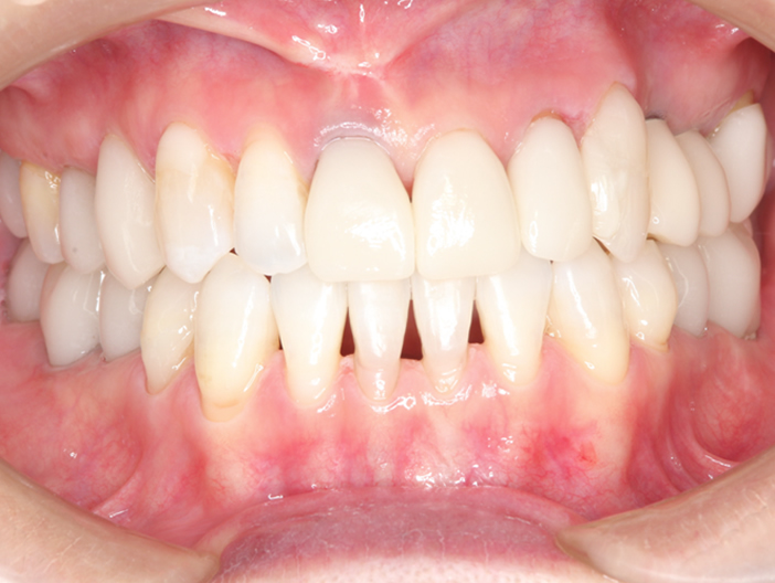 orthodontics-05.jpg