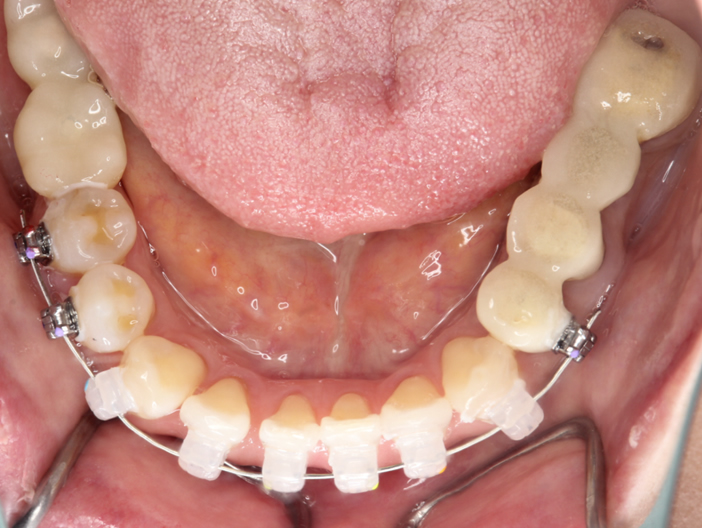 orthodontics-01-3.jpg