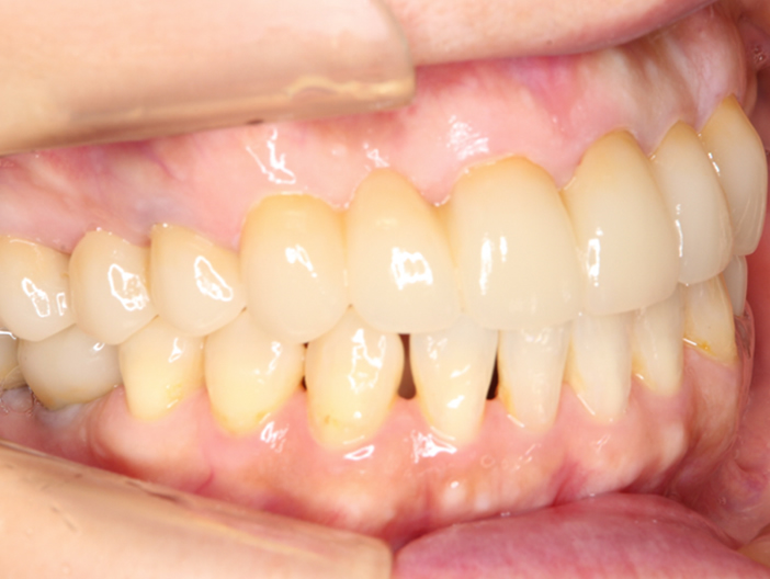 orthodontics-01-8.jpg