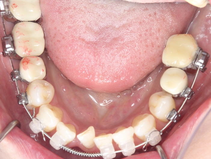 orthodontics-03.jpg