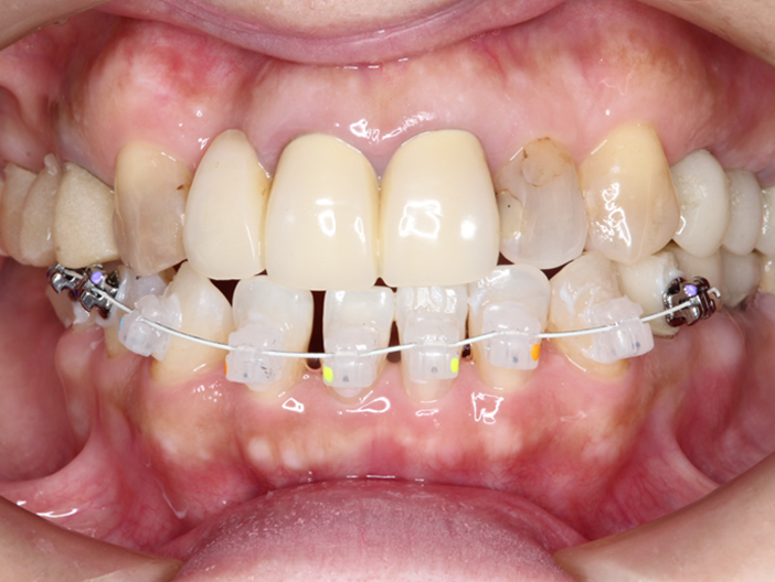 orthodontics-01-1.jpg