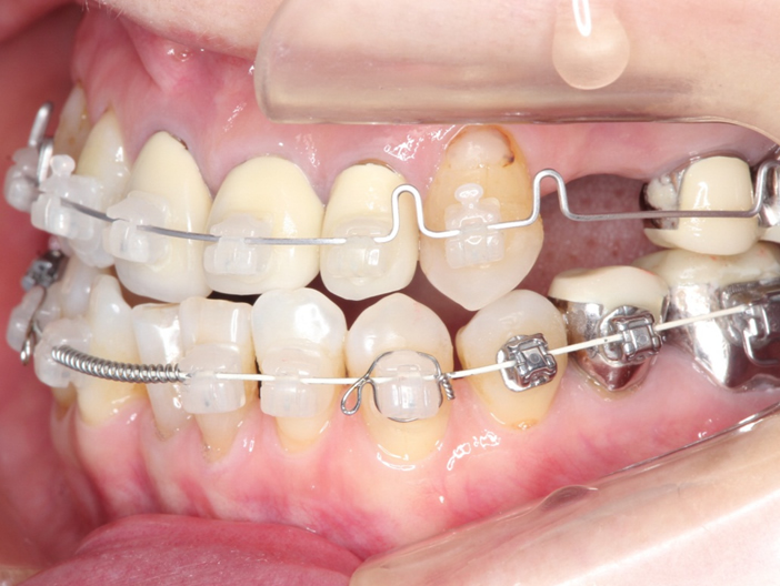 orthodontics-04.jpg